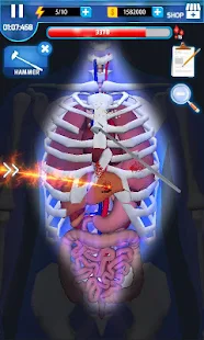   Surgery Master- screenshot thumbnail   